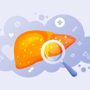 Kidney Profile-KFT & Renal Profile