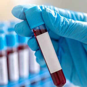 ABO Group & RH Type (Blood Group)