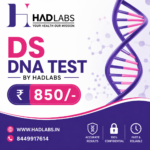 dsDNA Test | Anti-dsDNA Blood Test | HAD LABS