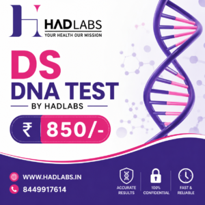 dsDNA Test | Anti-dsDNA Blood Test | HAD LABS